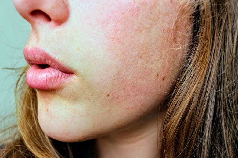 10 Common Daily Things That Can Cause Your Skin To Age