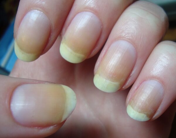 6 Of The Best Ways To Brighten Your Nails At Home.