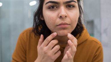 6 Possible Explanations Why Some Women Have Hair On Their Chins.