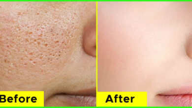 How To Minimize The Appearance Of Large Pores