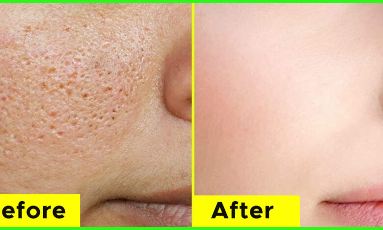 How To Minimize The Appearance Of Large Pores