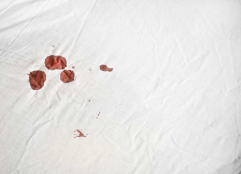 The Best Way To Remove Blood From Sheets.