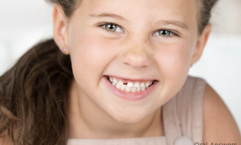 This is Why You Should Save Your Kids’ Baby Teeth