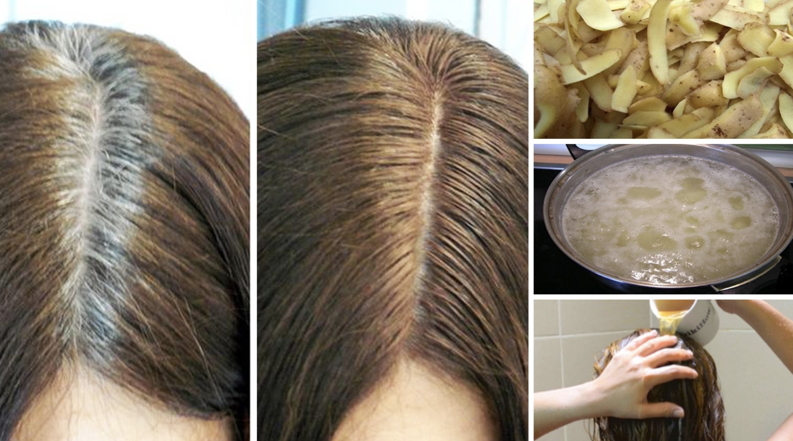 Use potato peels to get rid of grey hair