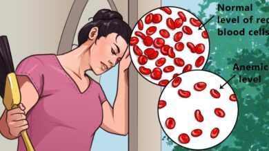 Headaches and fatigue are common symptoms of anemia. Here are 6 ways to treat it naturally
