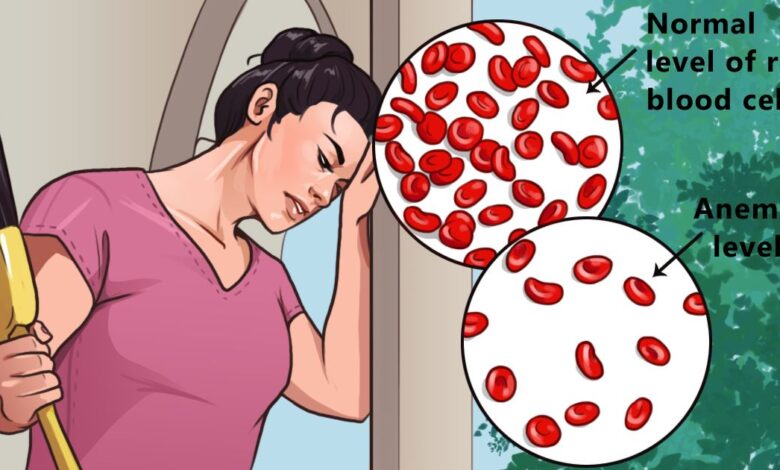 Headaches and fatigue are common symptoms of anemia. Here are 6 ways to treat it naturally